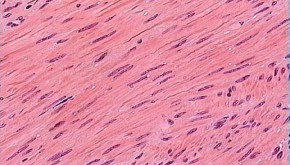 what is smooth muscle?